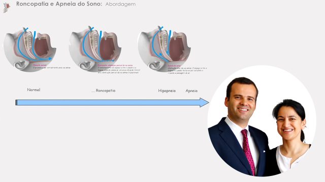 🇵🇹 Abordagem do Médico Dentista na Roncopatia y SAOS
