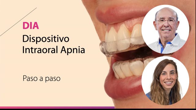 🇪🇸 Cómo aplicar el flujo digital en dispositivos intraorales: férulas de descarga y DIA