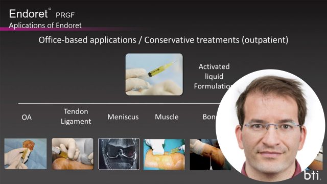 🇬🇧 Outpatient MSK clinical indications with PRGF – ENDORET®