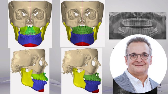 🇪🇸 La importancia de la Estructura Facial en la función orofacial