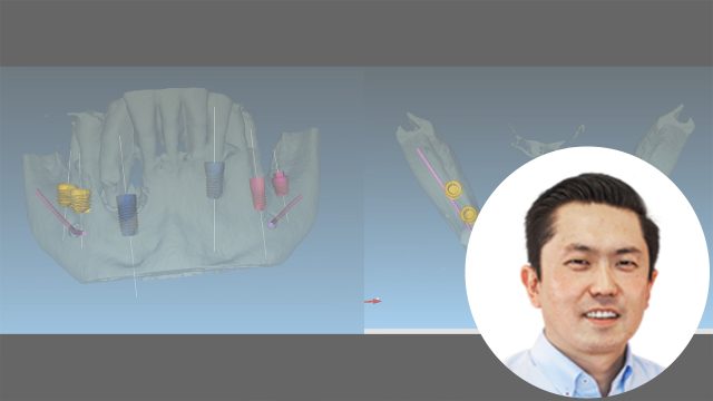 🇪🇸 Comunicación entre especialistas y laboratorio dental