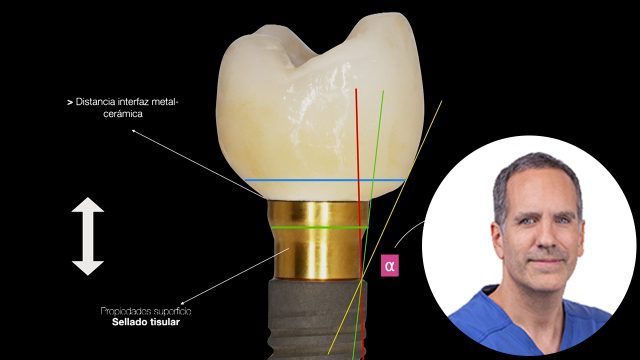 🇪🇸 Pilares Intermedios: el concepto Bioblock® y las claves para el éxito clínico
